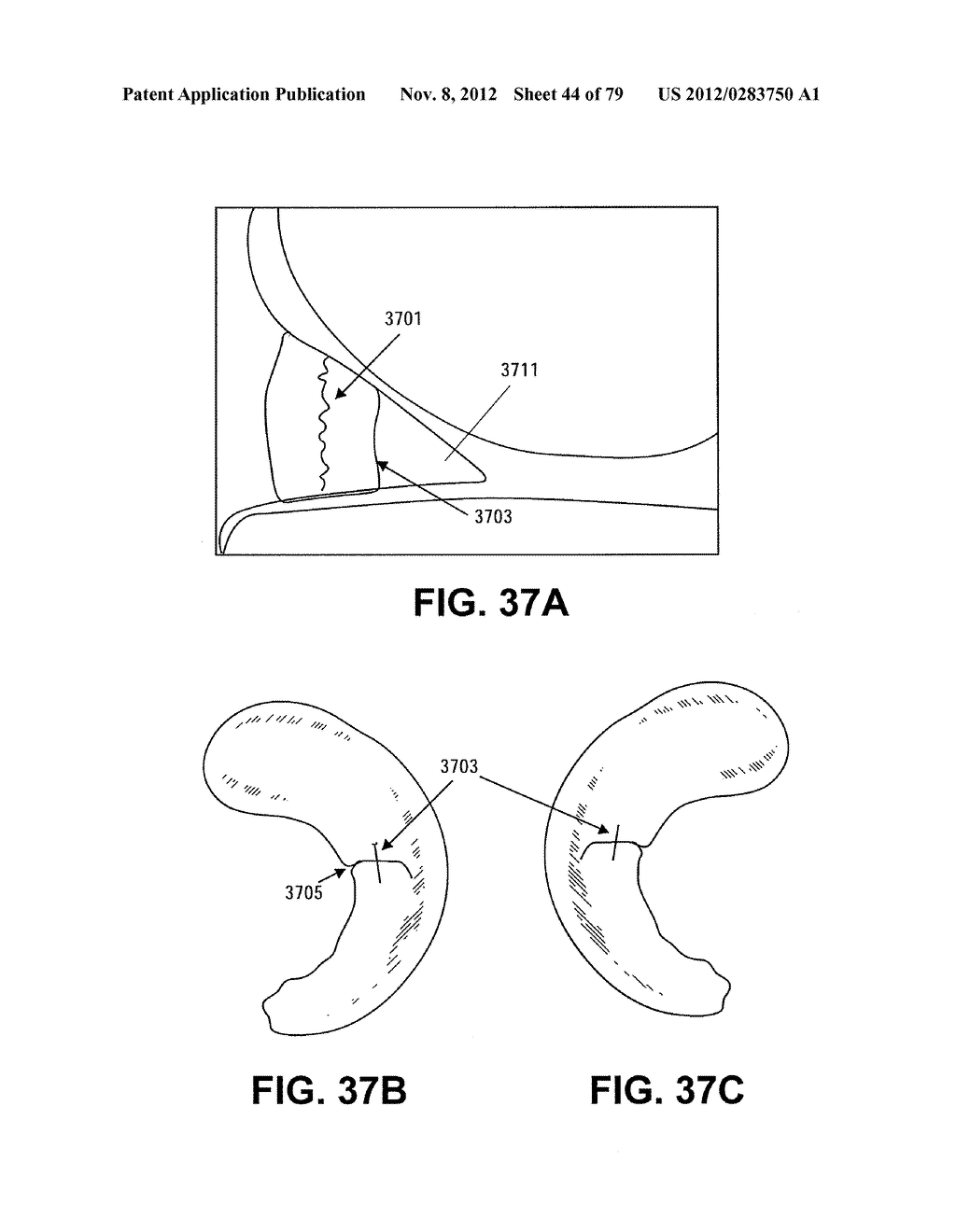 MENISCUS REPAIR - diagram, schematic, and image 45