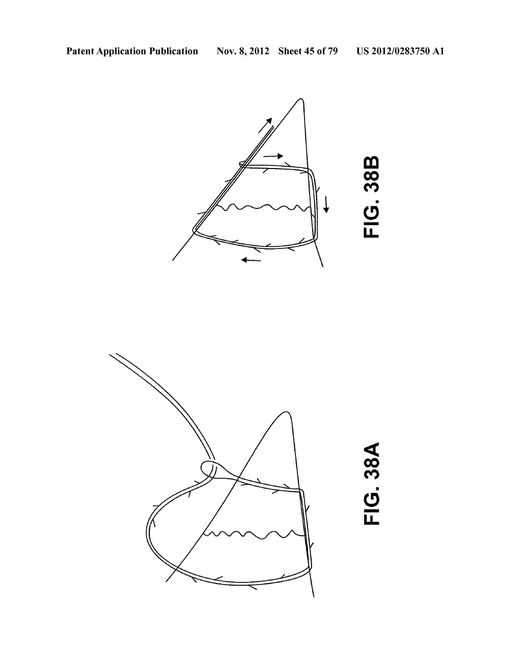 MENISCUS REPAIR - diagram, schematic, and image 46