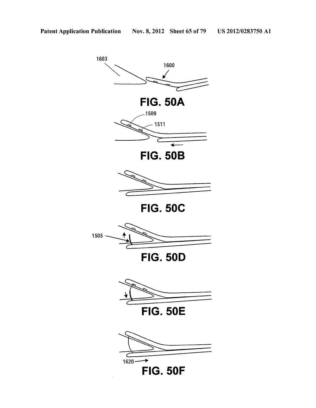 MENISCUS REPAIR - diagram, schematic, and image 66