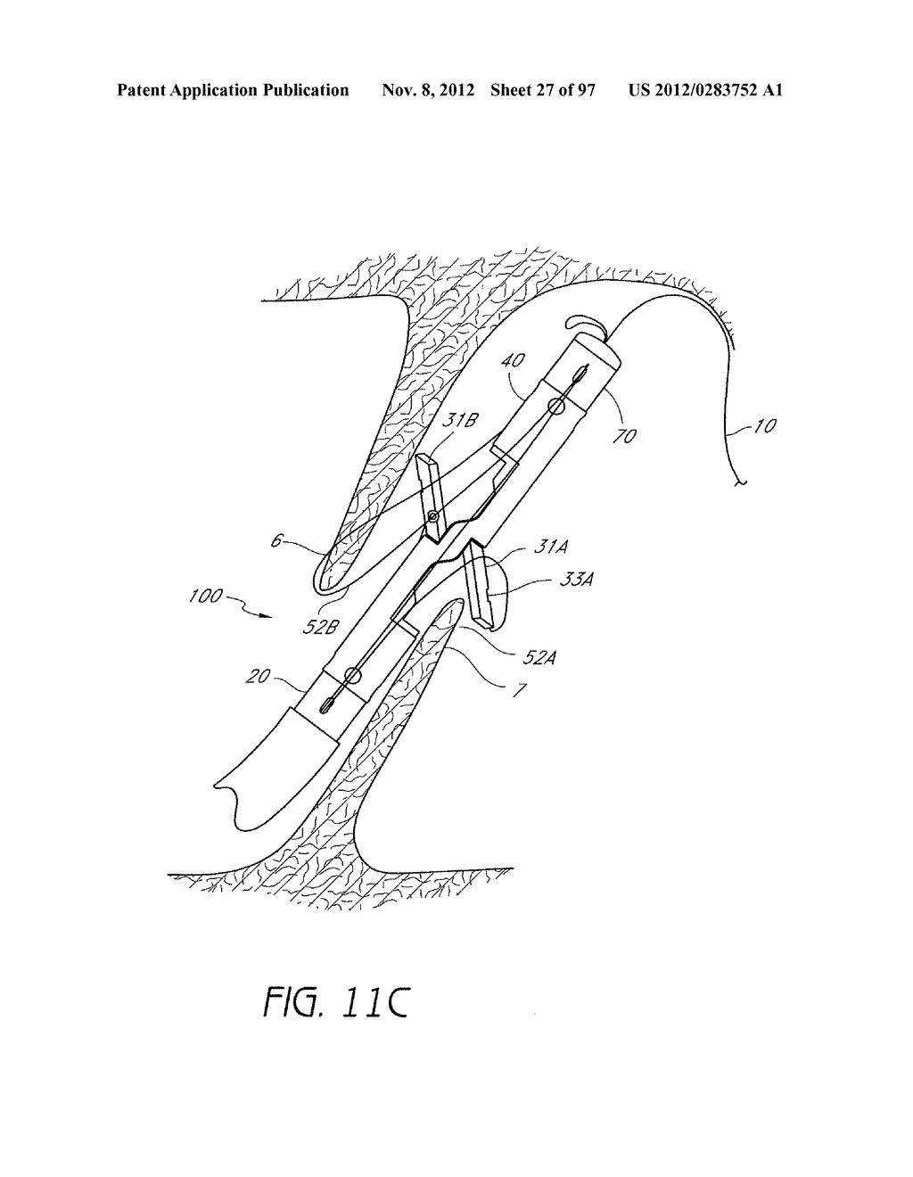 Suturing Devices and Methods for Closing a Patent Foramen Ovale - diagram, schematic, and image 28