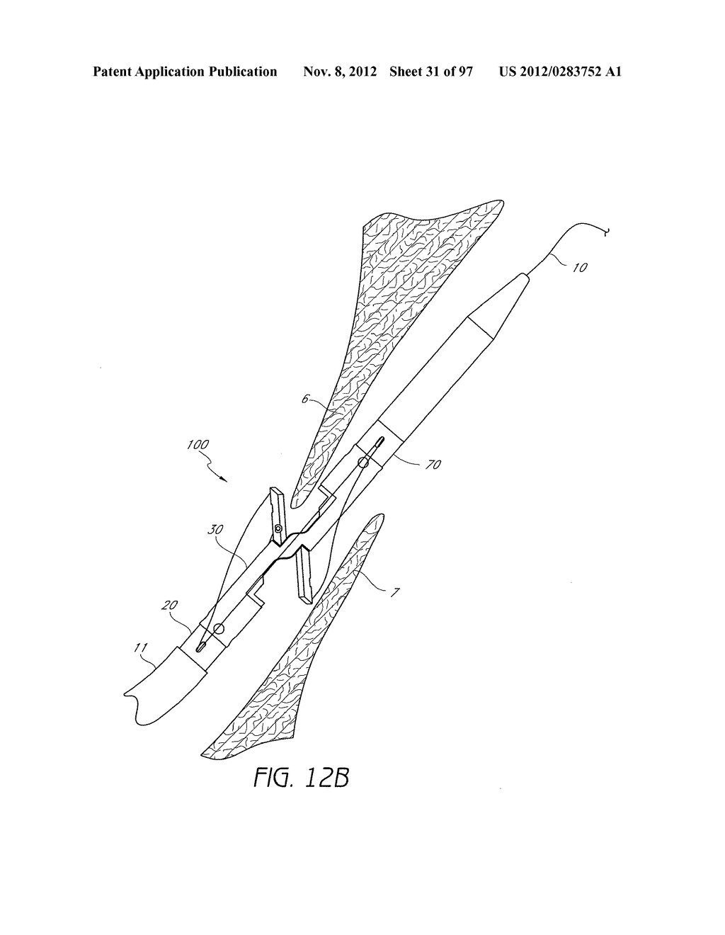 Suturing Devices and Methods for Closing a Patent Foramen Ovale - diagram, schematic, and image 32