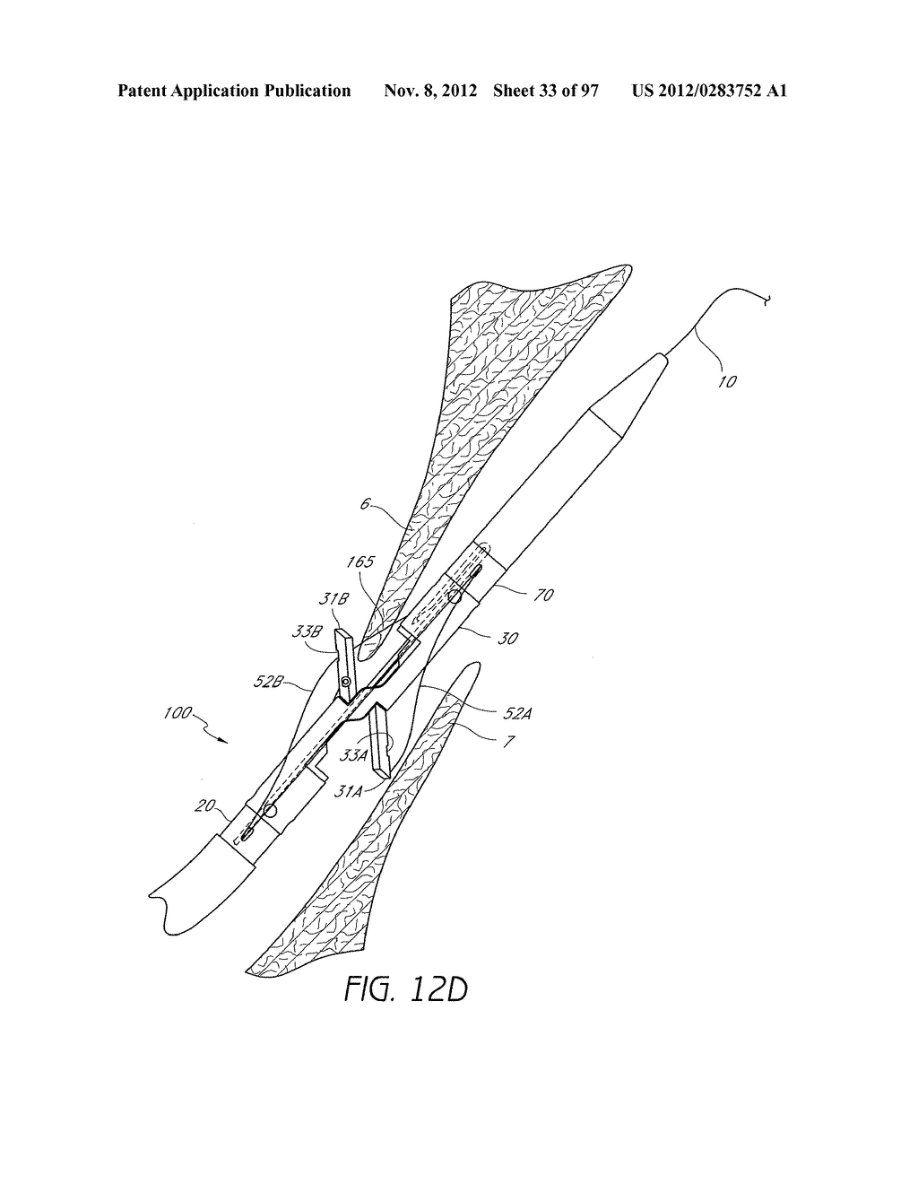 Suturing Devices and Methods for Closing a Patent Foramen Ovale - diagram, schematic, and image 34