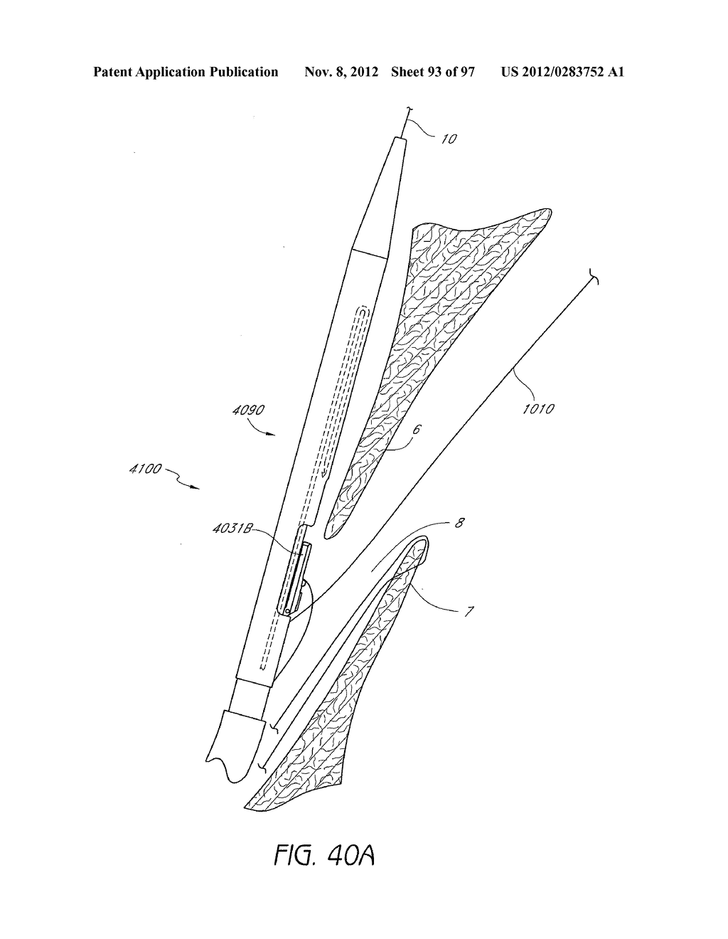 Suturing Devices and Methods for Closing a Patent Foramen Ovale - diagram, schematic, and image 94