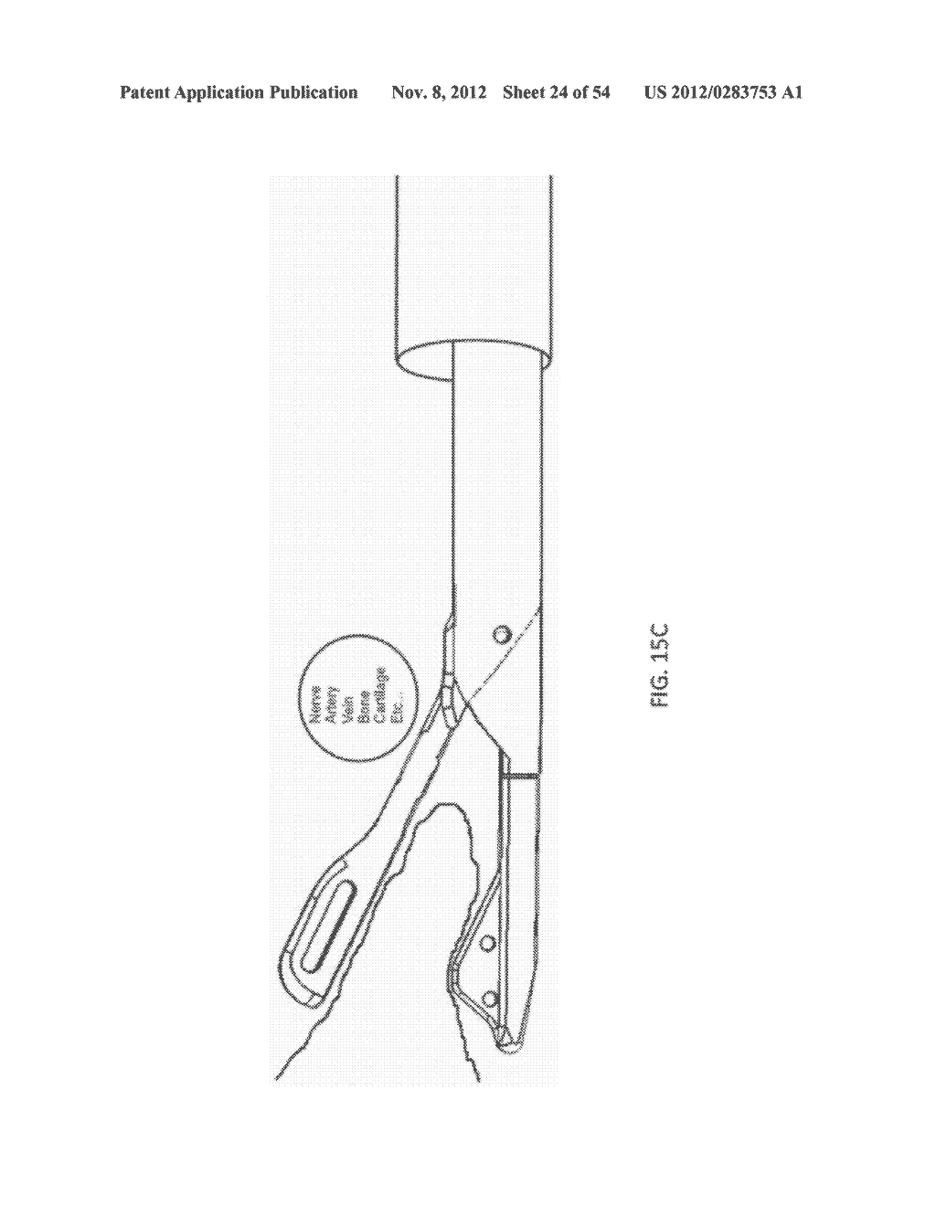 SUTURE PASSER DEVICES AND METHODS - diagram, schematic, and image 25