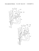 TISSUE ANCHOR FOR ANNULOPLASTY DEVICE diagram and image