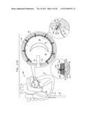 TISSUE ANCHOR FOR ANNULOPLASTY DEVICE diagram and image