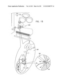 TISSUE ANCHOR FOR ANNULOPLASTY DEVICE diagram and image