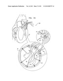 TISSUE ANCHOR FOR ANNULOPLASTY DEVICE diagram and image