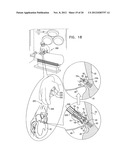 TISSUE ANCHOR FOR ANNULOPLASTY DEVICE diagram and image