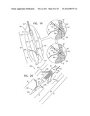 TISSUE ANCHOR FOR ANNULOPLASTY DEVICE diagram and image