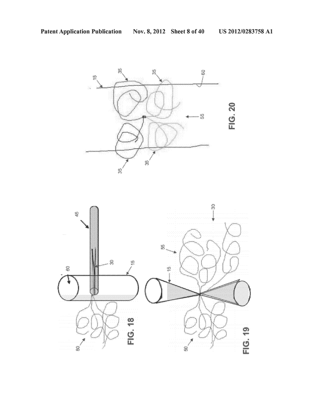 METHOD AND APPARATUS FOR TREATING VARICOSE VEINS - diagram, schematic, and image 09