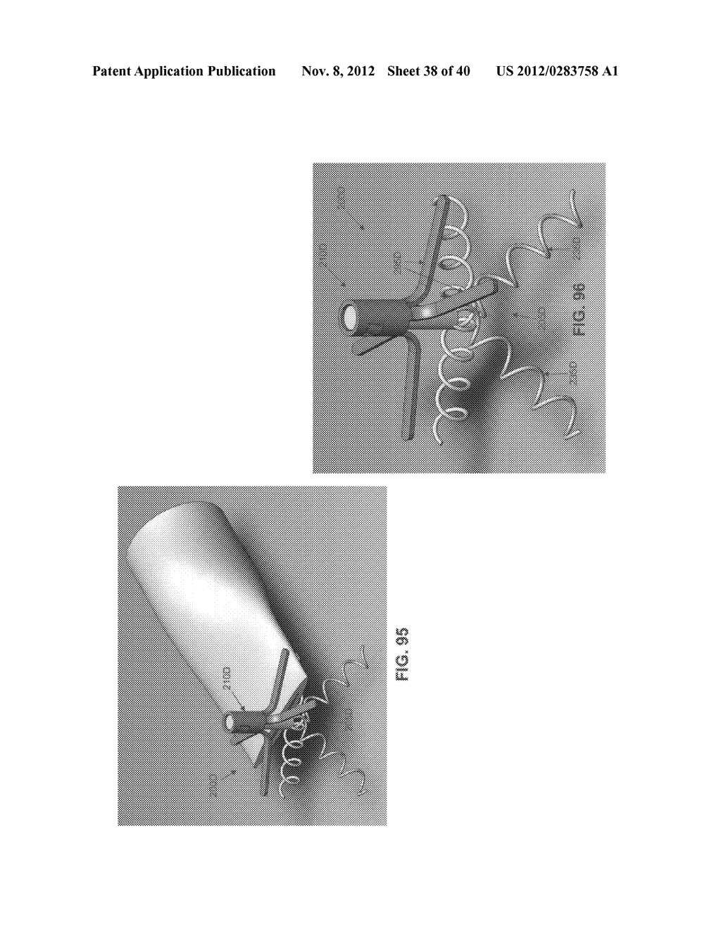 METHOD AND APPARATUS FOR TREATING VARICOSE VEINS - diagram, schematic, and image 39