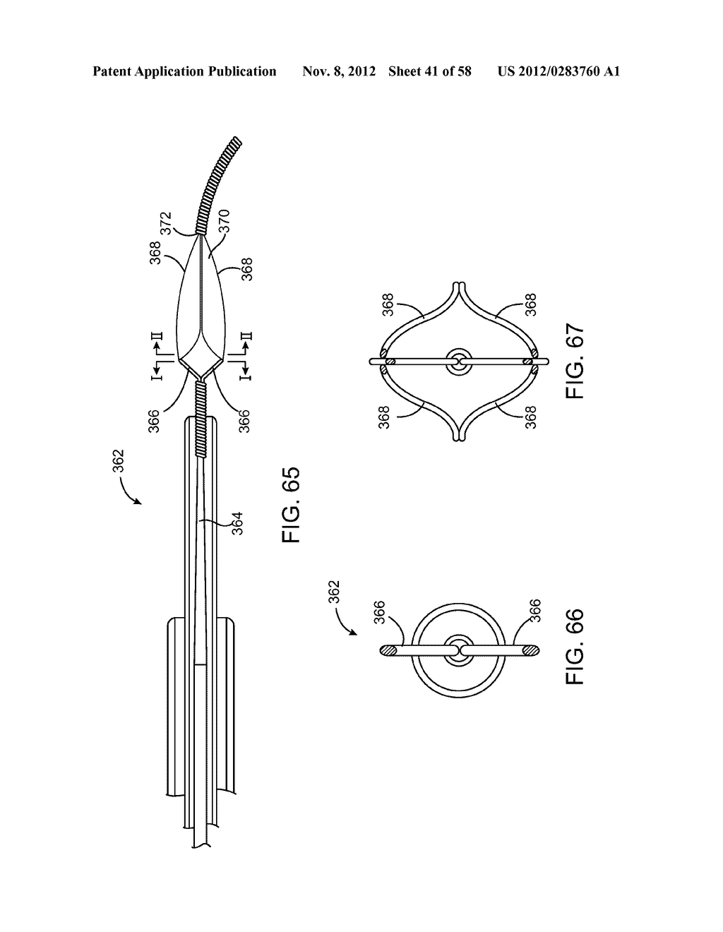 SYSTEMS, METHODS AND DEVICES FOR REMOVING OBSTRUCTIONS FROM A BLOOD VESSEL - diagram, schematic, and image 42