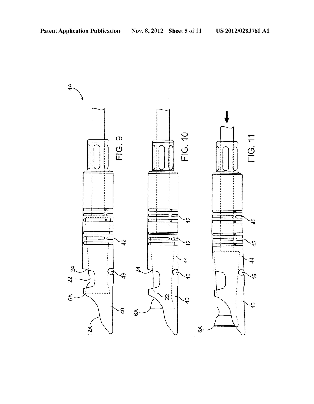 METHODS AND DEVICES FOR CUTTING TISSUE AT A VASCULAR LOCATION - diagram, schematic, and image 06