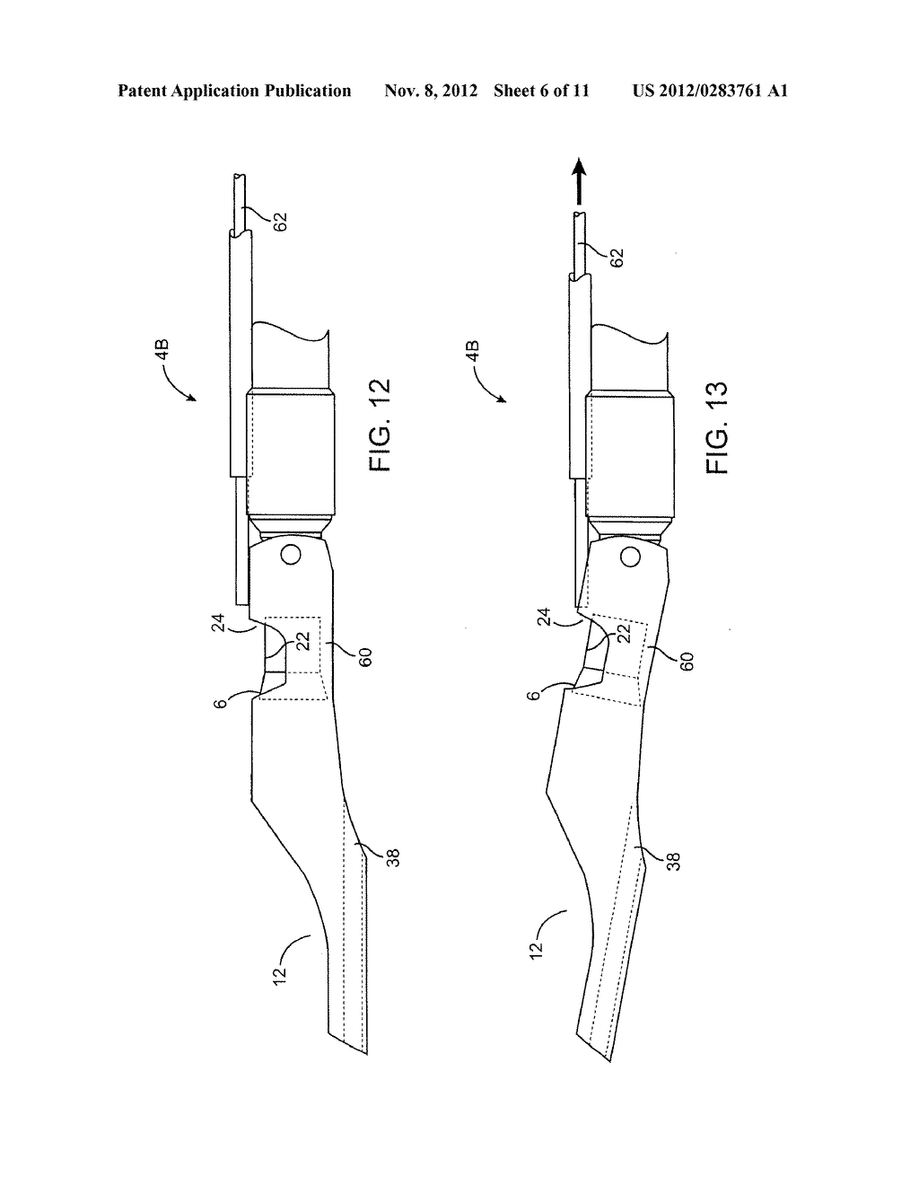 METHODS AND DEVICES FOR CUTTING TISSUE AT A VASCULAR LOCATION - diagram, schematic, and image 07