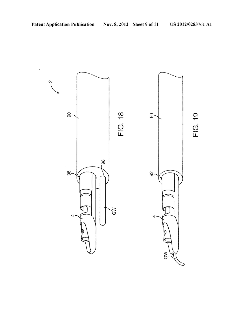 METHODS AND DEVICES FOR CUTTING TISSUE AT A VASCULAR LOCATION - diagram, schematic, and image 10