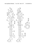 ANEURYSM COIL DELIVERY SYSTEM diagram and image