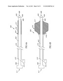 ANEURYSM COIL DELIVERY SYSTEM diagram and image