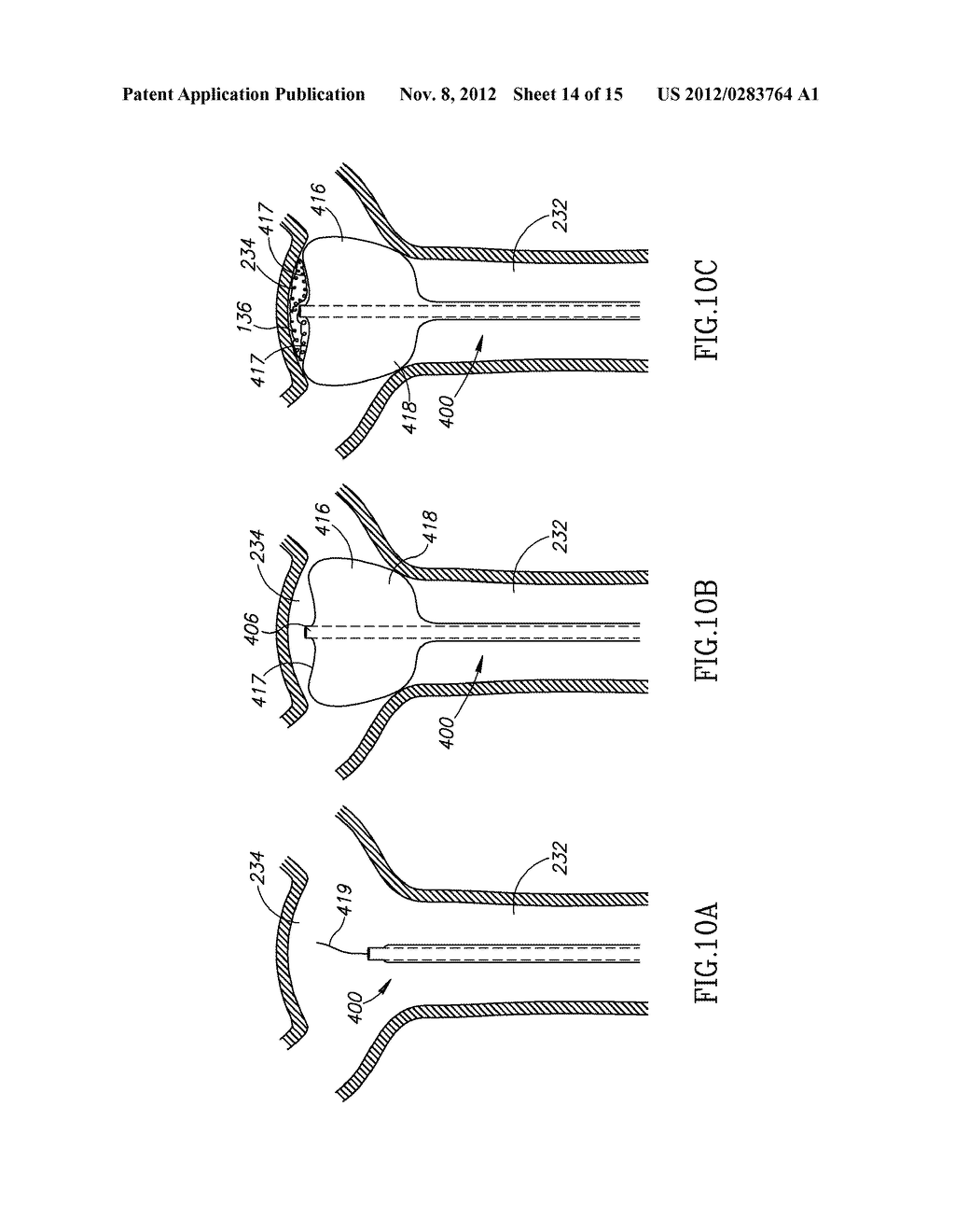 ANEURYSM COIL DELIVERY SYSTEM - diagram, schematic, and image 15