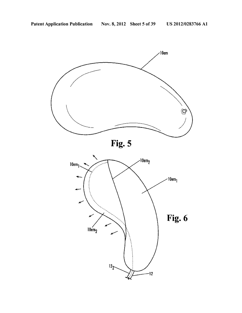 Devices and Methods for Treatment of Obesity - diagram, schematic, and image 06