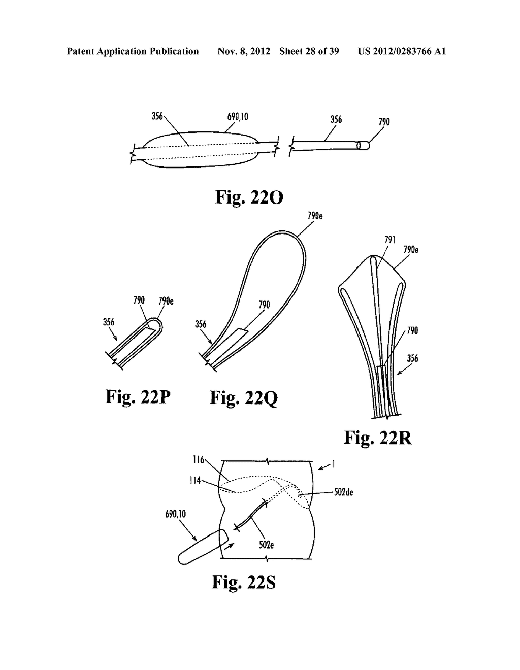 Devices and Methods for Treatment of Obesity - diagram, schematic, and image 29