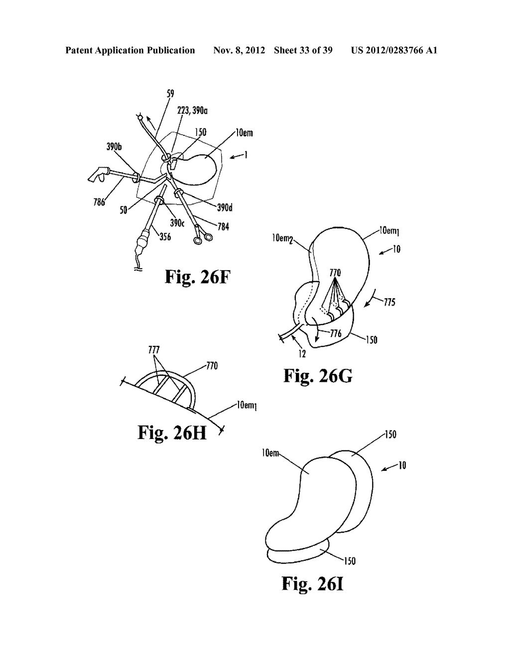 Devices and Methods for Treatment of Obesity - diagram, schematic, and image 34