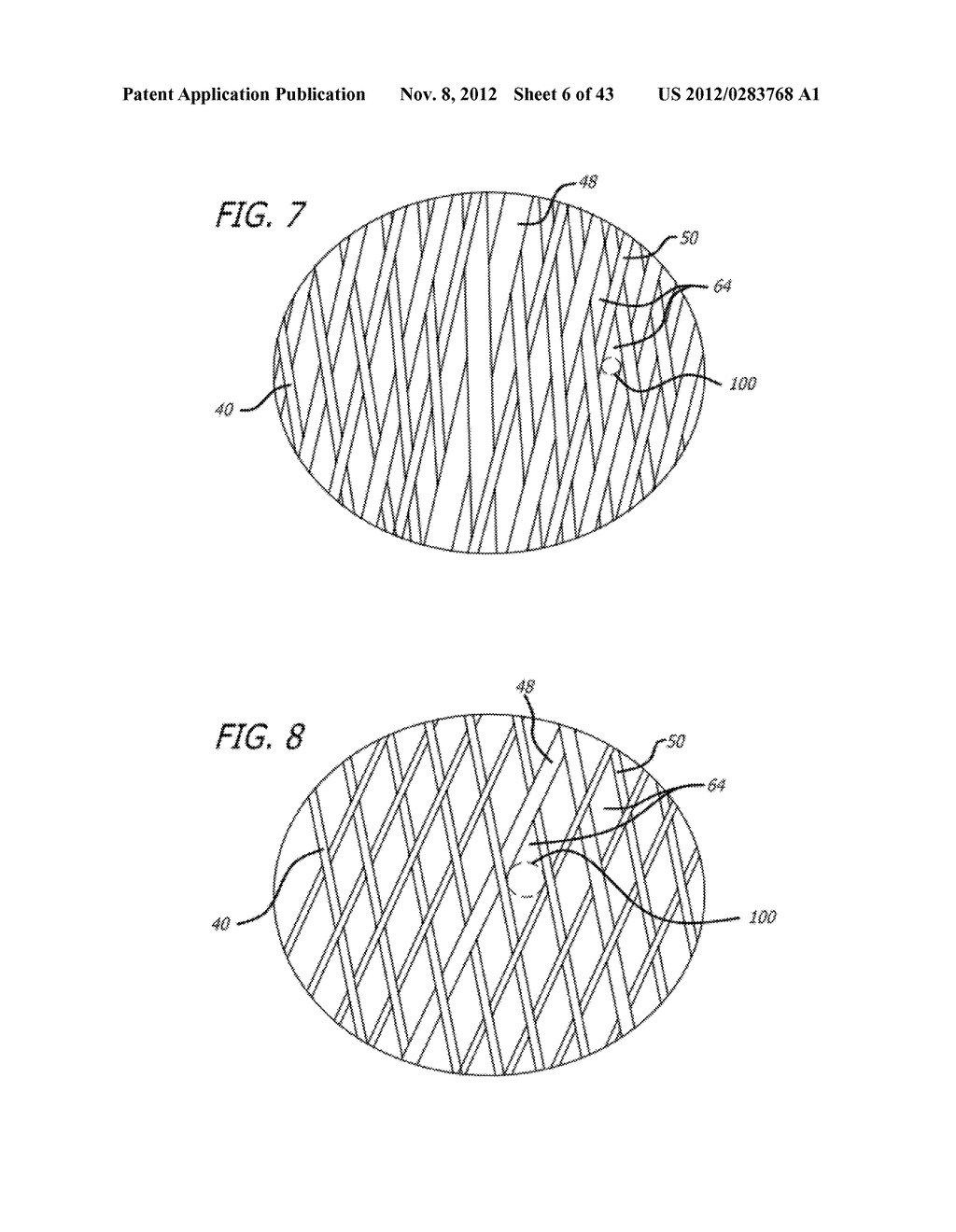 METHOD AND APPARATUS FOR THE TREATMENT OF LARGE AND GIANT VASCULAR DEFECTS - diagram, schematic, and image 07