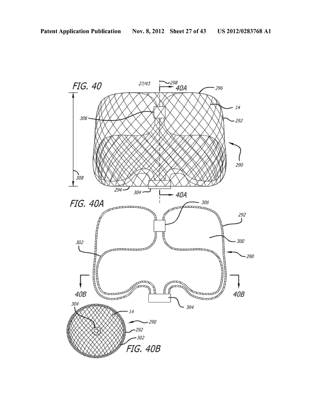 METHOD AND APPARATUS FOR THE TREATMENT OF LARGE AND GIANT VASCULAR DEFECTS - diagram, schematic, and image 28