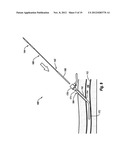 COMPRESSIBLE ARTERIOTOMY LOCATOR FOR VASCULAR CLOSURE DEVICES AND METHODS diagram and image