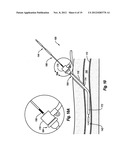 COMPRESSIBLE ARTERIOTOMY LOCATOR FOR VASCULAR CLOSURE DEVICES AND METHODS diagram and image