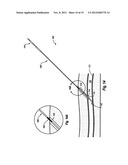 COMPRESSIBLE ARTERIOTOMY LOCATOR FOR VASCULAR CLOSURE DEVICES AND METHODS diagram and image