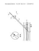 COMPRESSIBLE ARTERIOTOMY LOCATOR FOR VASCULAR CLOSURE DEVICES AND METHODS diagram and image