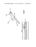 COMPRESSIBLE ARTERIOTOMY LOCATOR FOR VASCULAR CLOSURE DEVICES AND METHODS diagram and image