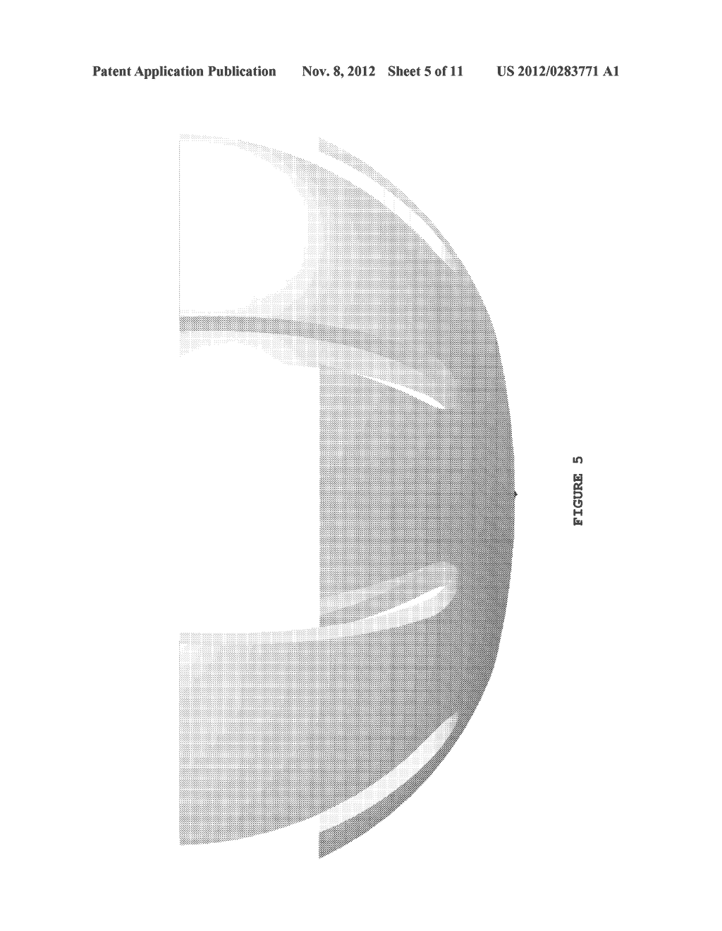 Craniotomy Plugs - diagram, schematic, and image 06