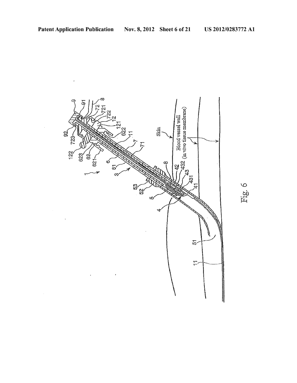 TISSUE CLOSURE AND TISSUE CLOSING DEVICE - diagram, schematic, and image 07