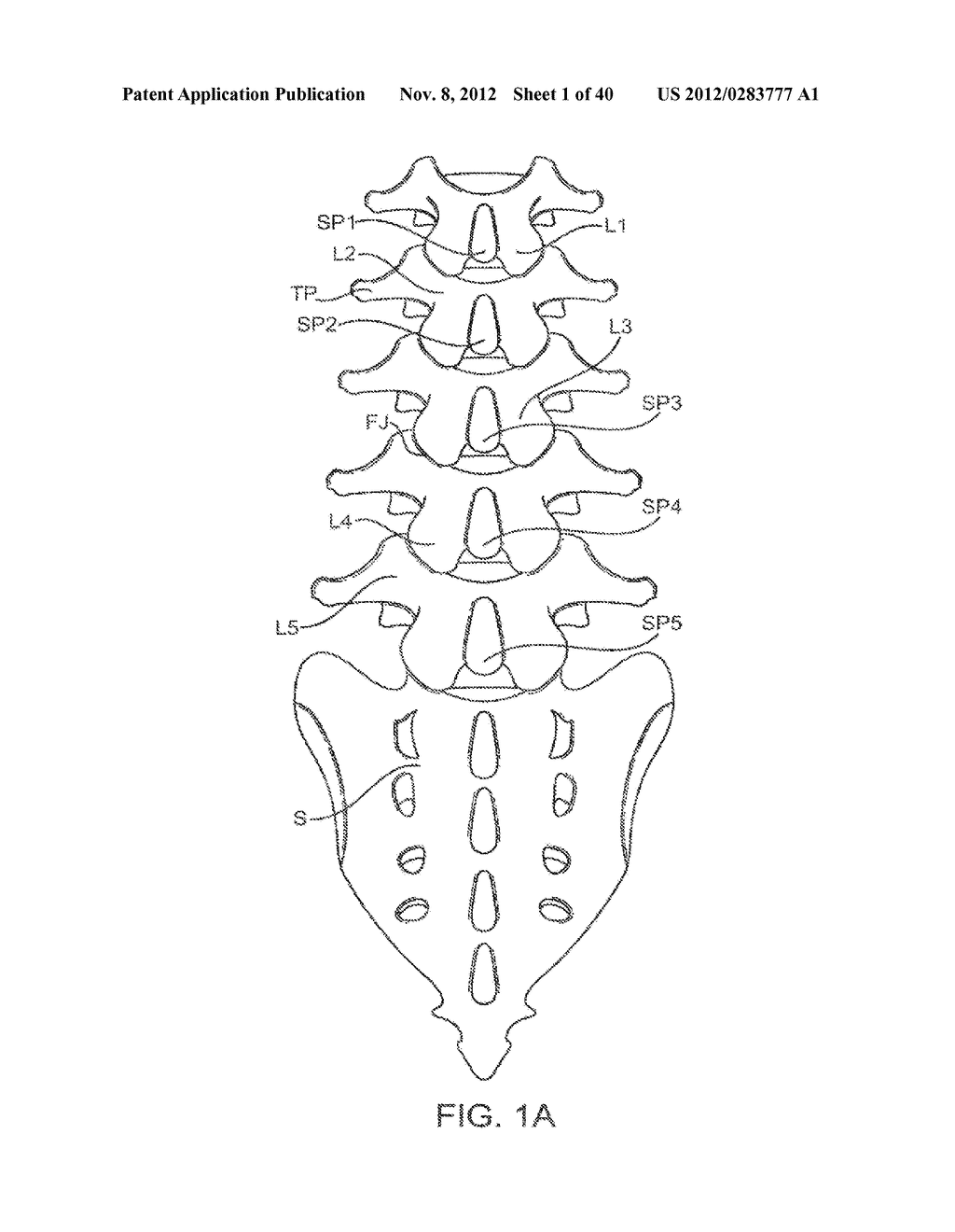 METHODS AND APPARATUS FOR DEPLOYING SPINOUS PROCESS CONSTRAINTS - diagram, schematic, and image 02