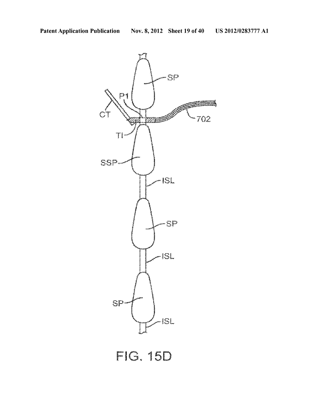 METHODS AND APPARATUS FOR DEPLOYING SPINOUS PROCESS CONSTRAINTS - diagram, schematic, and image 20