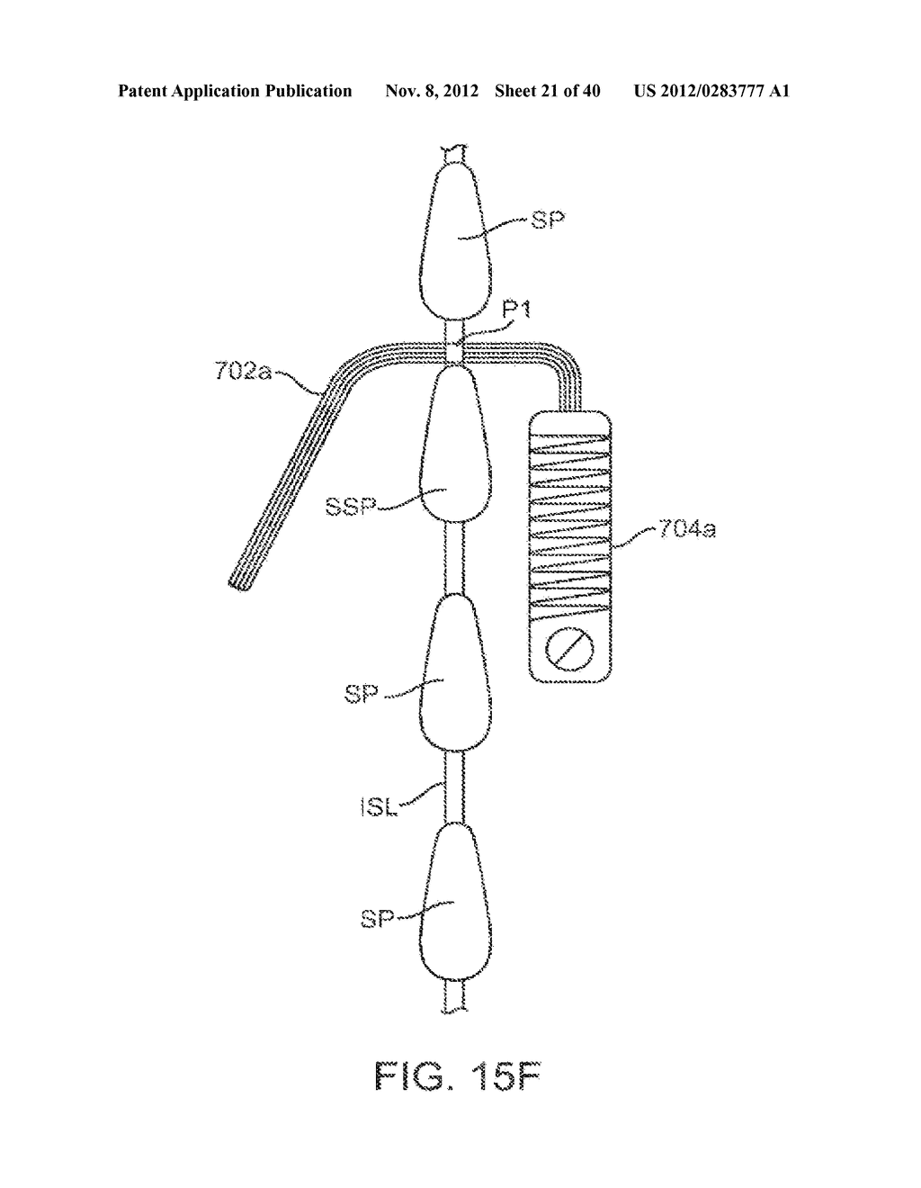 METHODS AND APPARATUS FOR DEPLOYING SPINOUS PROCESS CONSTRAINTS - diagram, schematic, and image 22