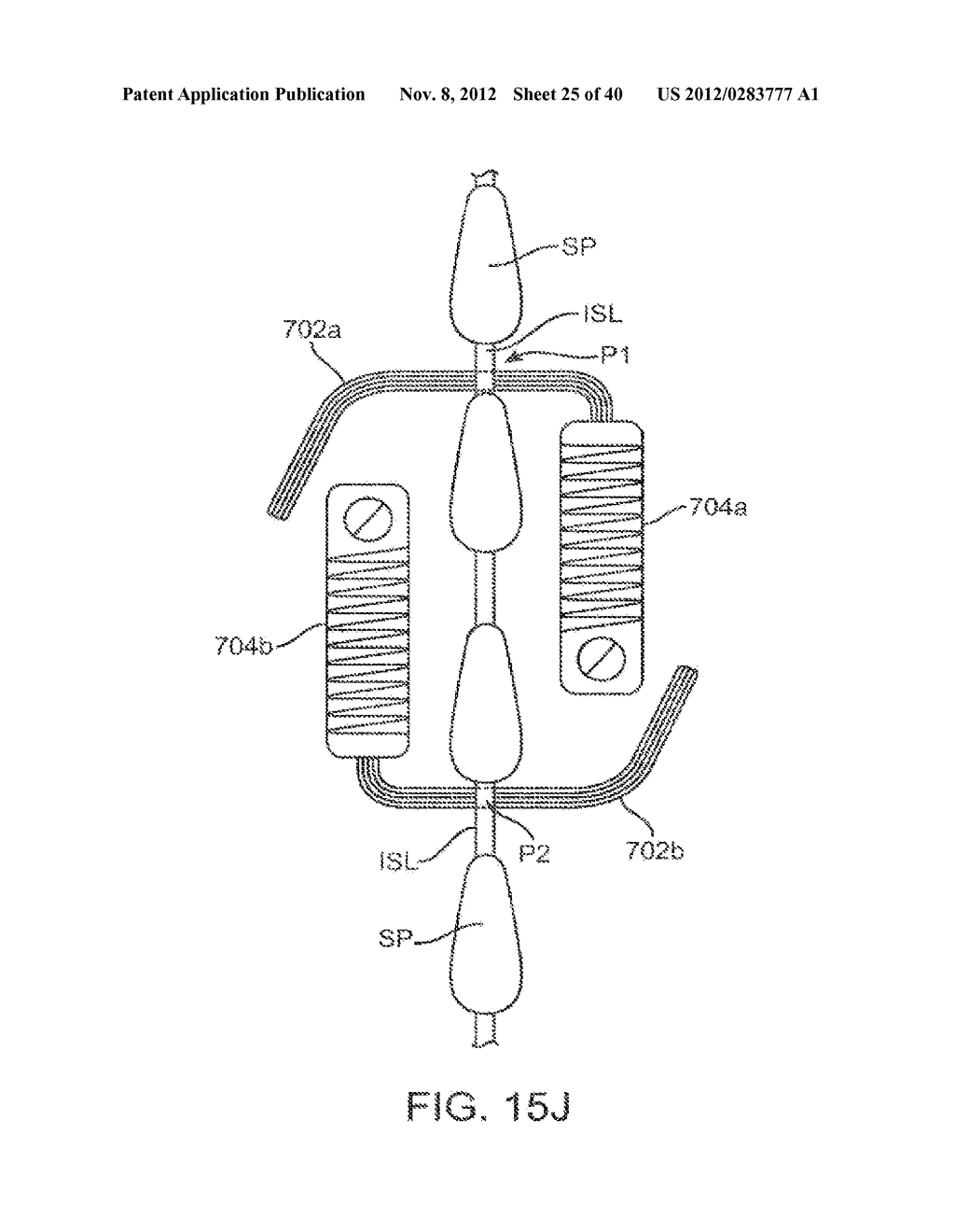 METHODS AND APPARATUS FOR DEPLOYING SPINOUS PROCESS CONSTRAINTS - diagram, schematic, and image 26