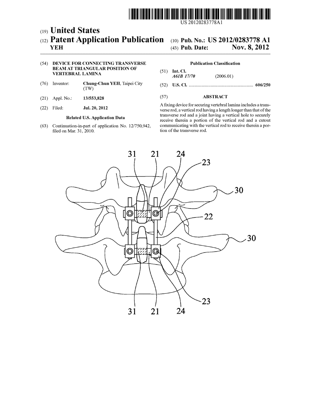 DEVICE FOR CONNECTING TRANSVERSE BEAM AT TRIANGULAR POSITION OF VERTEBRAL     LAMINA - diagram, schematic, and image 01