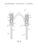 ROD ATTACHMENT FOR HEAD TO HEAD CROSS CONNECTOR diagram and image