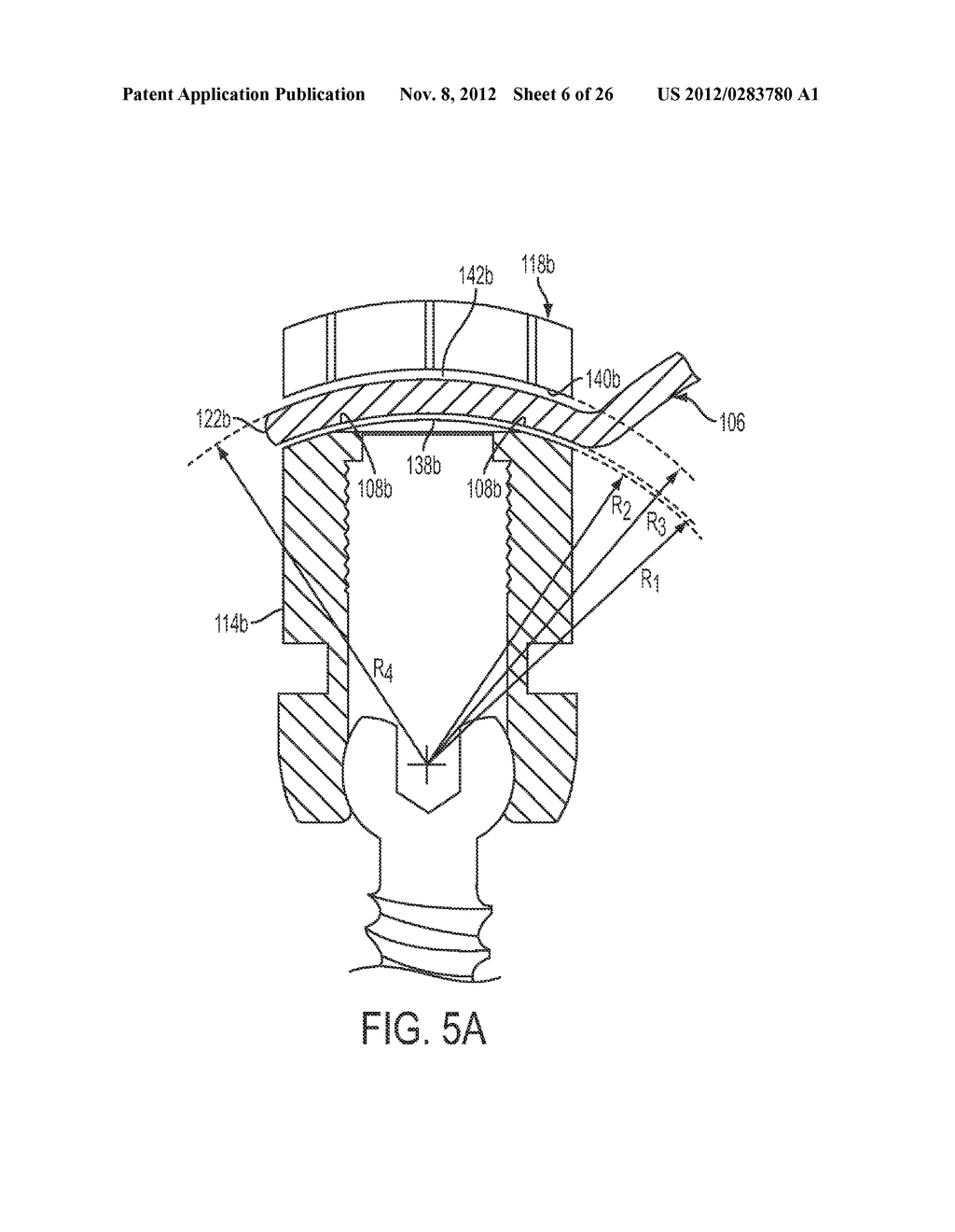 ROD ATTACHMENT FOR HEAD TO HEAD CROSS CONNECTOR - diagram, schematic, and image 07