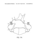 ROD ATTACHMENT FOR HEAD TO HEAD CROSS CONNECTOR diagram and image