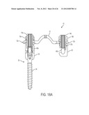 ROD ATTACHMENT FOR HEAD TO HEAD CROSS CONNECTOR diagram and image