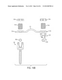 ROD ATTACHMENT FOR HEAD TO HEAD CROSS CONNECTOR diagram and image