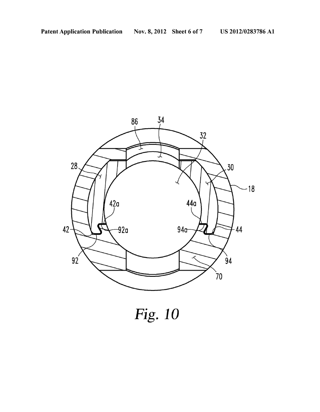 ANCHORS EXTENDER ASSEMBLIES AND METHODS FOR USING - diagram, schematic, and image 07