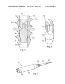 MEDICAL APPARATUS, AND SURGICAL METHOD diagram and image