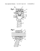 BONE ANCHORING DEVICE diagram and image