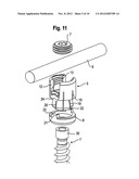 BONE ANCHORING DEVICE diagram and image