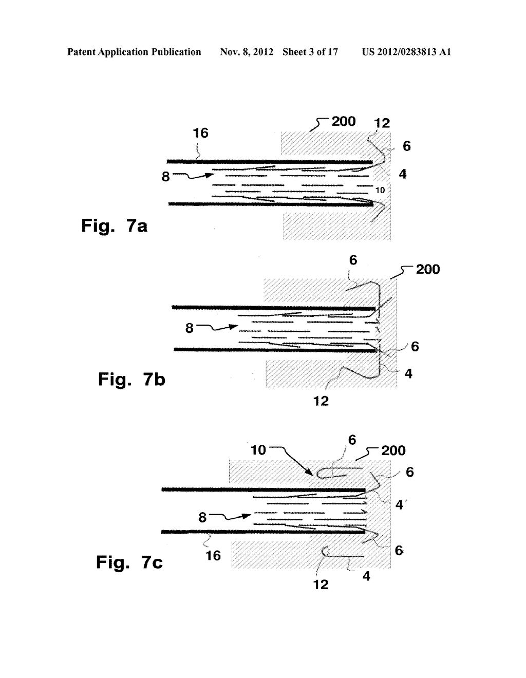 Tissue Penetration Device And Method - diagram, schematic, and image 04